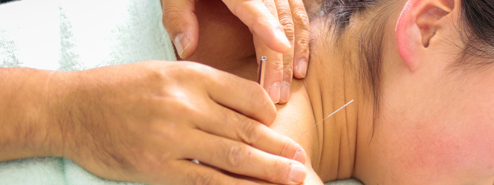 タイトル：一般針